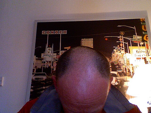 A bald man's head